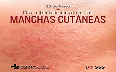 25 • MAYO • DÍA INTERNACIONAL DE LAS MANCHAS CUTÁNEAS